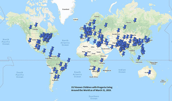 progeria map