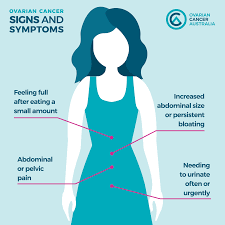 sign of ovarian cancer